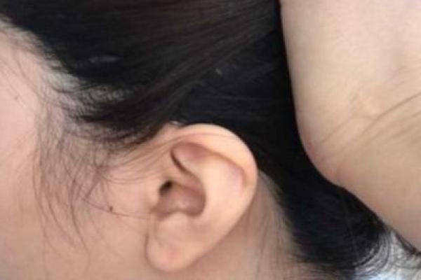 痣相女神的秘密：脸蛋与耳朵的完美搭配