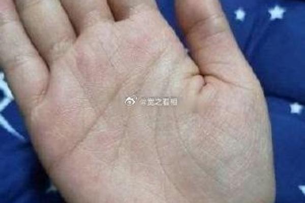 手相揭秘：青筋突起预示大富大贵！