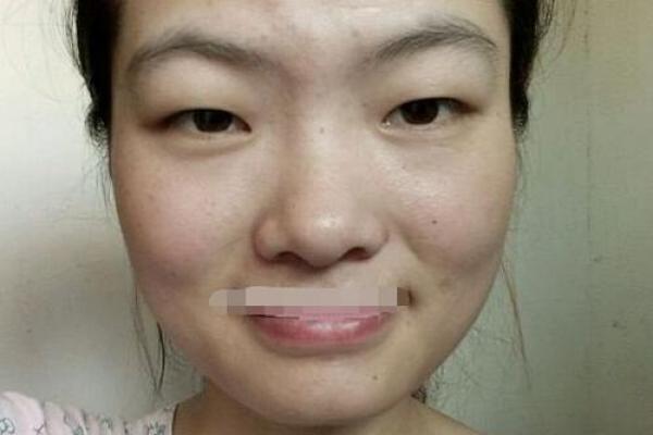 山根青筋，小孩面相中的天赋异禀？揭秘未来潜力股！