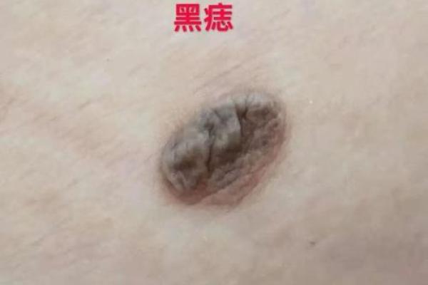 肚脐痣男，他们的爱情观有何不同？
