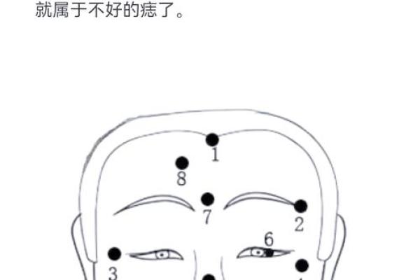 痣头奇缘，揭秘你的运势密码！