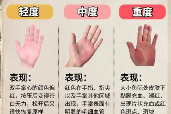 病了手相揭秘：揭秘身体健康的密码