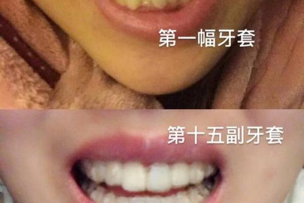 牙根露面，运势大爆发！