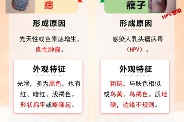 揭秘：这些痣相可能预示着不幸，你中招了吗？