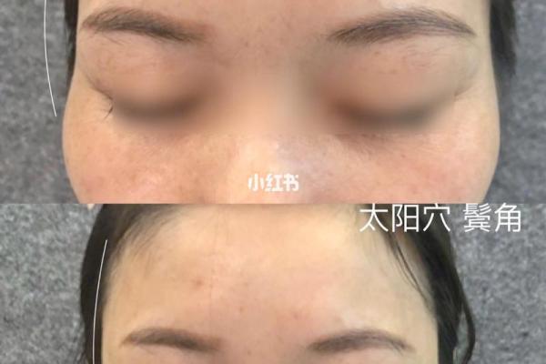 鬓角后扬面相解析：预示着智慧与好运的汇聚