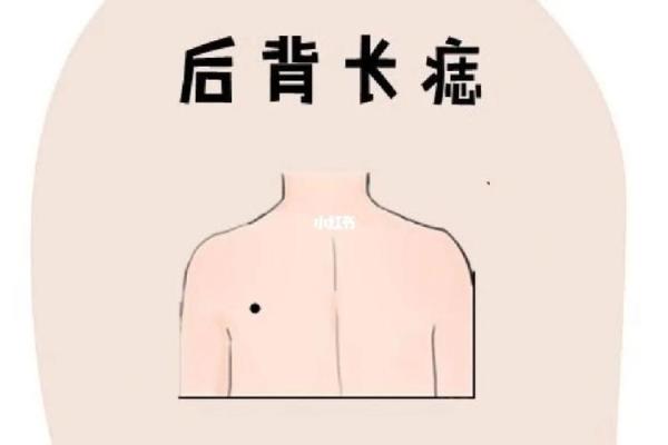 脊柱痣相解析：探寻你的命运轨迹