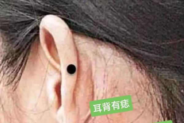痣相揭秘：耳屏有痣，财运亨通？