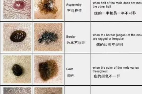 神秘痣相：脖喉之痣，预示着什么非凡命运？